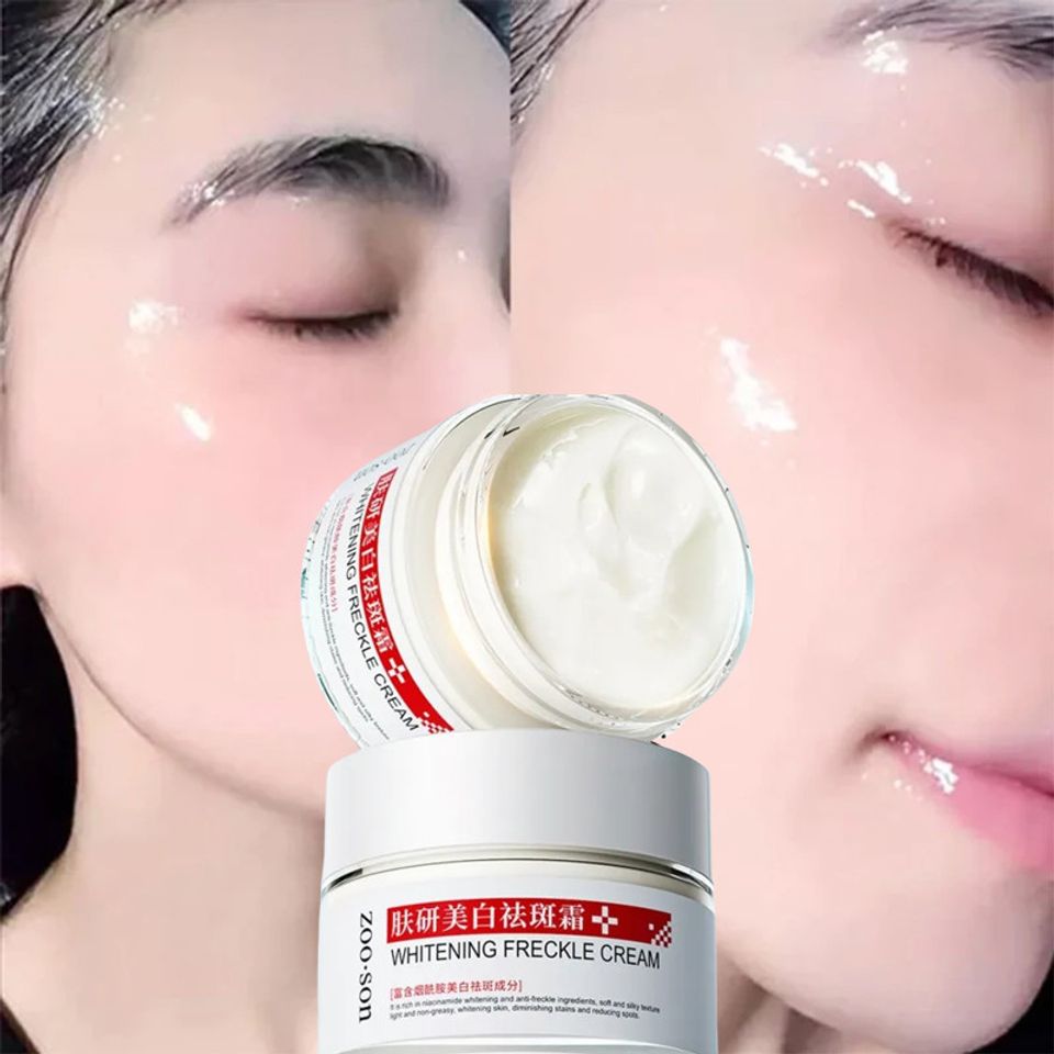 Kem nám tàn nhang Kem dưỡng trắng da mặt 50g kem trắng da mặt kem nám kem tàn nhang kem xóa tàn nhang
