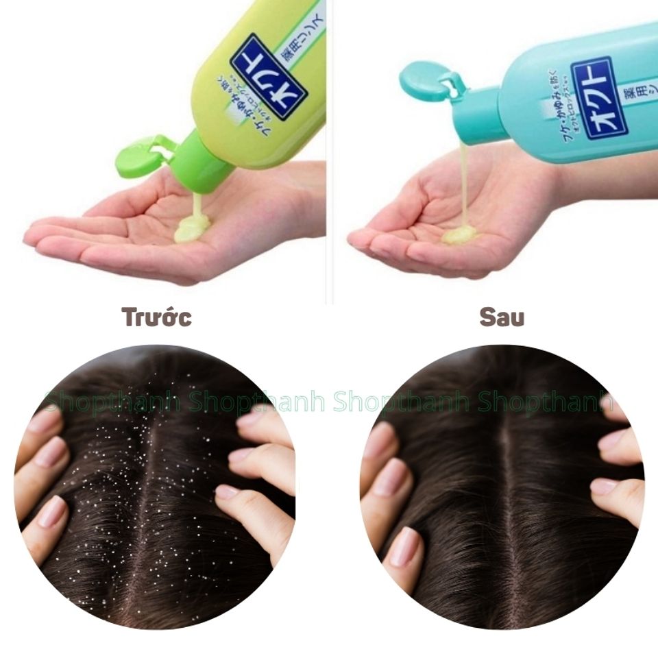 Dầu Gội Nhật Bản Lion Mohatsuryoku  – Làm Sạch Da Đầu, Giúp Tóc Khỏe Mạnh, Hỗ Trợ Sạch Gàu Tóc Khỏe