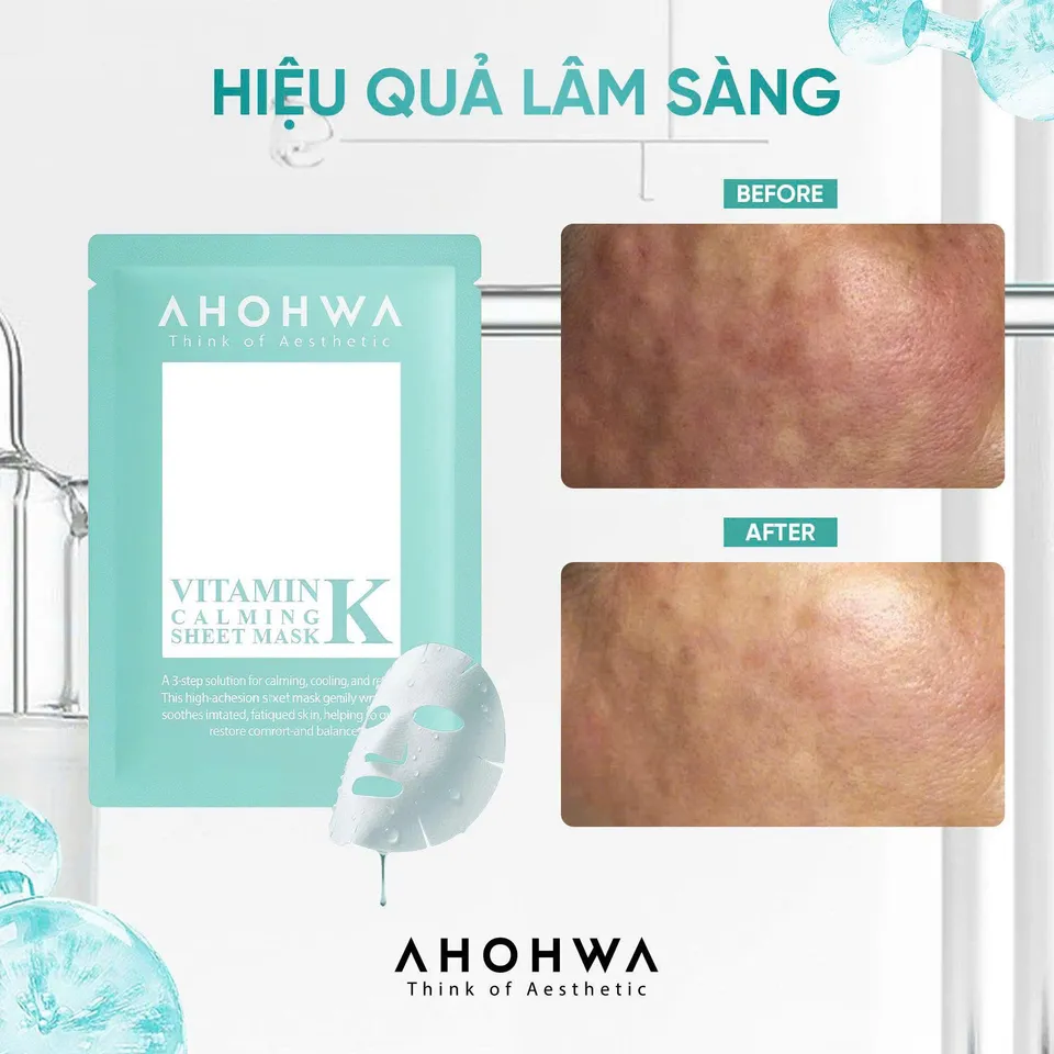 5 miếng] Mặt nạ Ahohwa VITAMIN K SHEET MASK – PHỤC HỒI DA SAU XÂM LẤN phù  hợp với mọi loại da